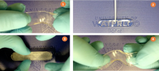 (1) Sal-gel in its first, melted state, is soft and transparent. (2) Secondary nucleation is initiated by touching the gel with salt crystals. (3) Sal-gel in its secondary, frozen state, is rigid and opaque. (4) The gel is heated at ~90 C to revert it to the initial melted state.